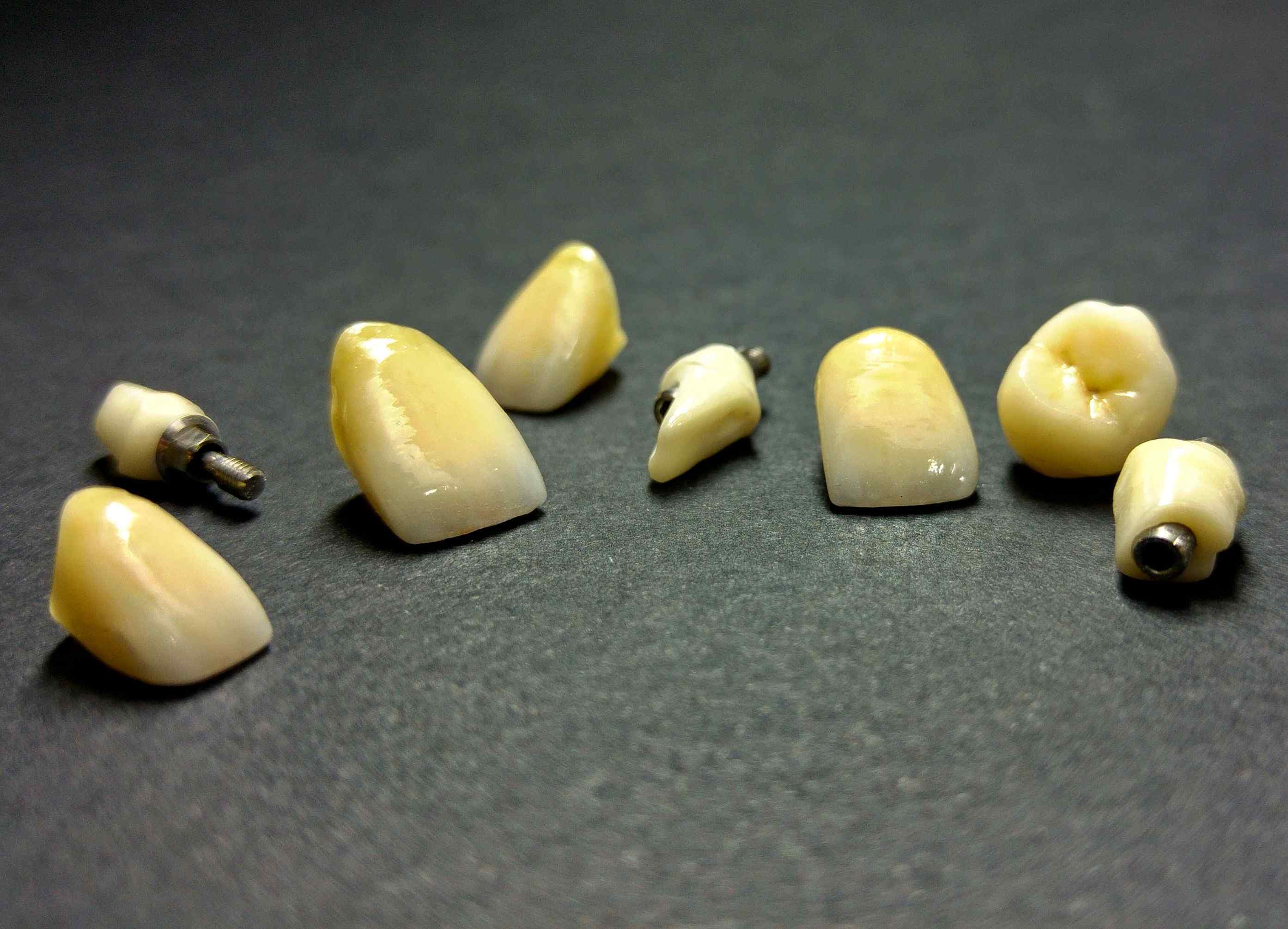 טכנאות שיניים SR Dentline