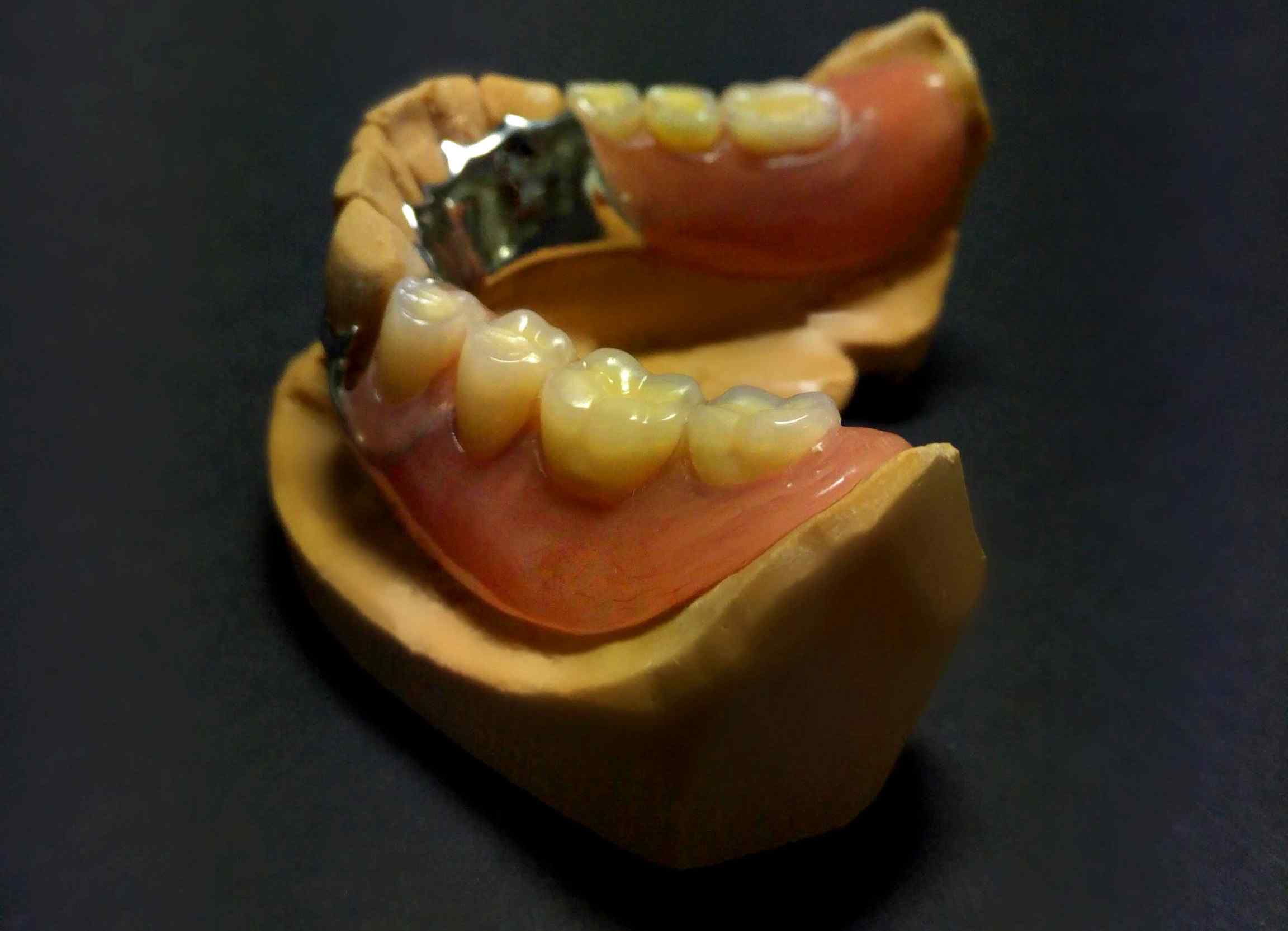 טכנאות שיניים SR Dentline